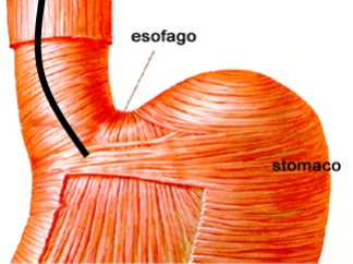 Hamer: Il carcinoma dell’esofago